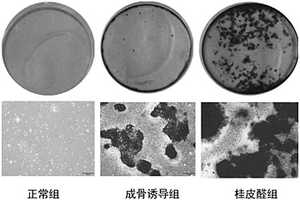 骨生長促進劑、生物復(fù)合材料及其制備方法和生物支架