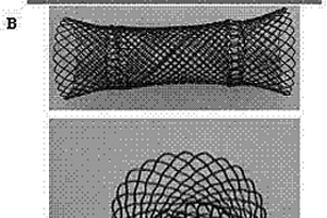 具有增強、增韌效應(yīng)的可降解納米復(fù)合空腔臟器支架