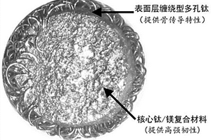 半降解鈦鎂復(fù)合微球骨填充醫(yī)用材料