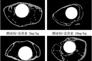 姜黃素在糖尿病條件下醫(yī)用鈦合金內(nèi)植物中的應(yīng)用