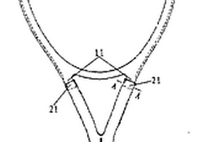 網(wǎng)球拍框架改良結(jié)構(gòu)