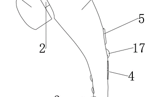 氣道廓清治療裝置和方法