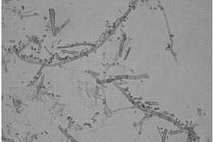 枝孢菌株及其微生物菌劑以及制備方法和應(yīng)用