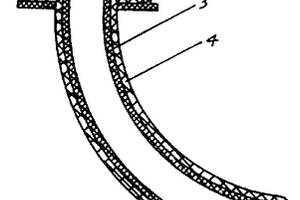 醫(yī)療用氣管套管