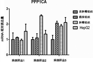 PPP1CA作為肝癌診斷和檢測(cè)預(yù)后的標(biāo)志物及其應(yīng)用