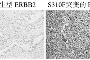 ERBB2 S310F突變的抗體在制備診斷檢測(cè)膽囊癌中的應(yīng)用