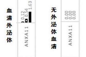 血清外泌體ANXA11在診斷胰腺癌中的應用